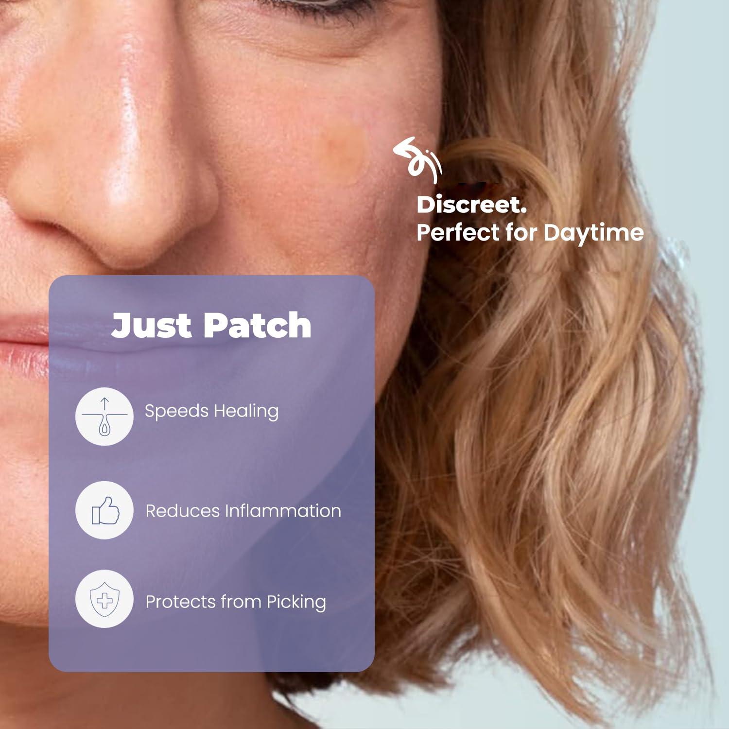 Parches Hidrocoloides RoselynBoutique para Granitos - 30 Unidades