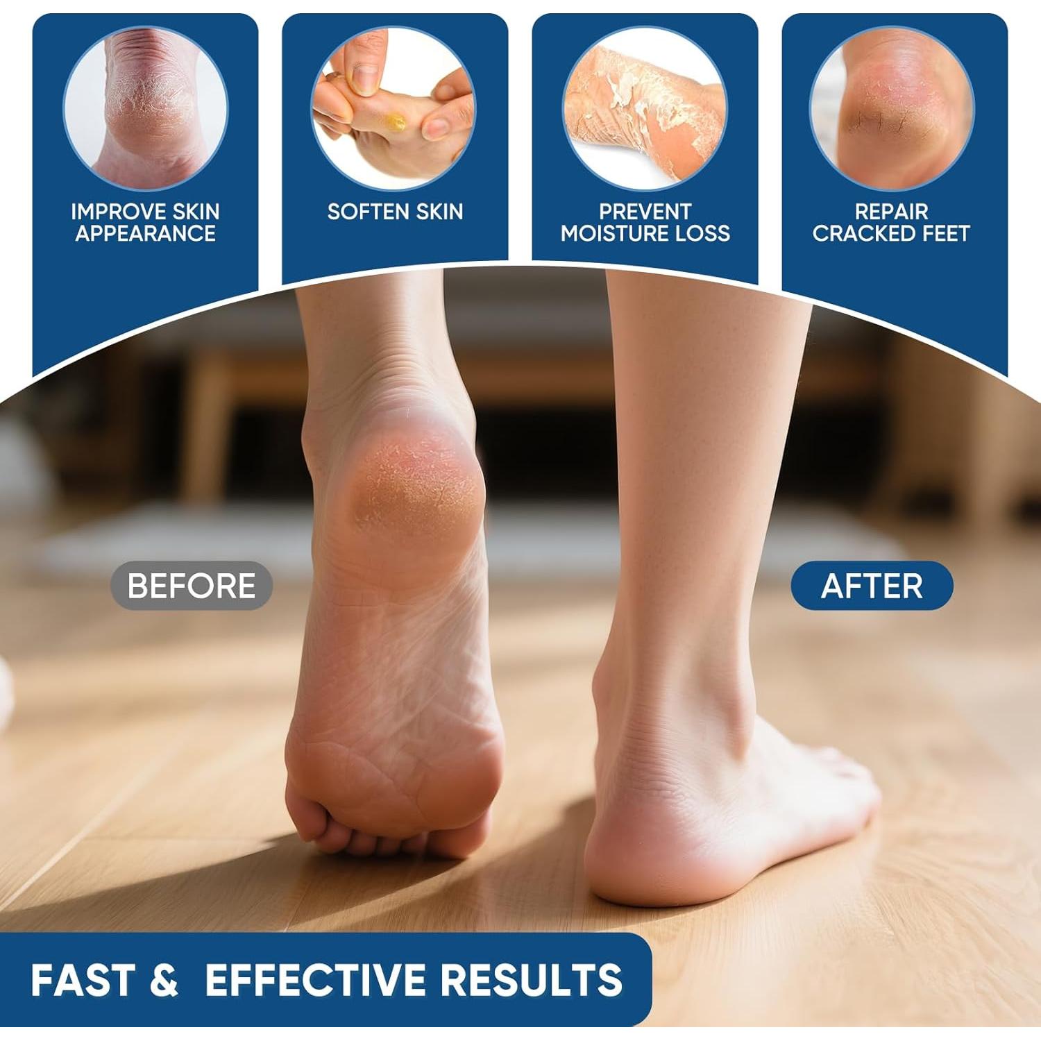 Crema de Urea 40% VREKEF con Ácido Salicílico 2% para Pies