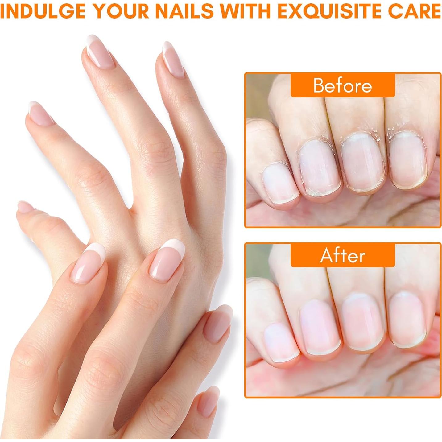 Bolígrafo Aceite Cutículas Makartt 12 Piezas Hidratante