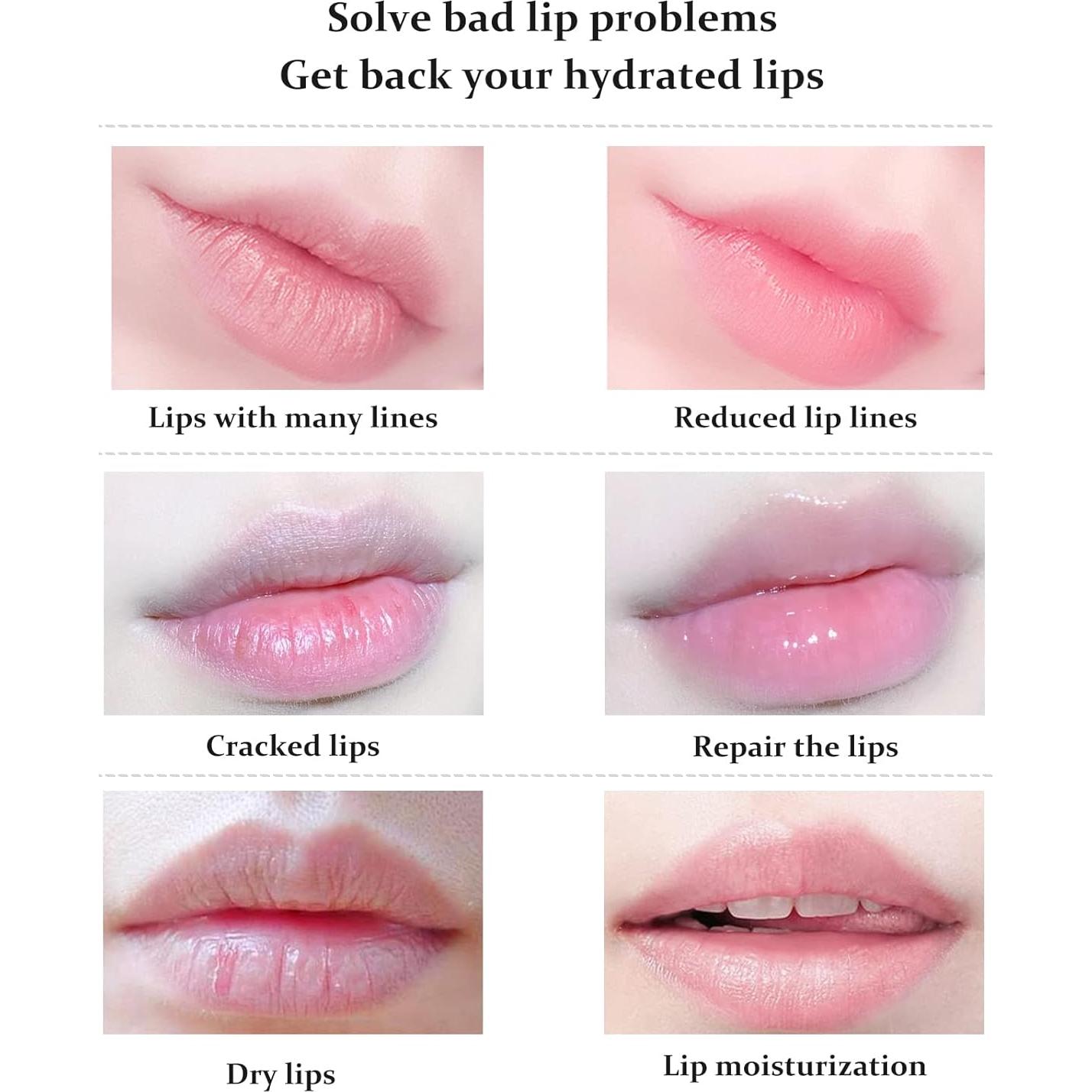 20 Mascarillas Hidratantes para Labios FREEORR - Gel Colágeno Rosa