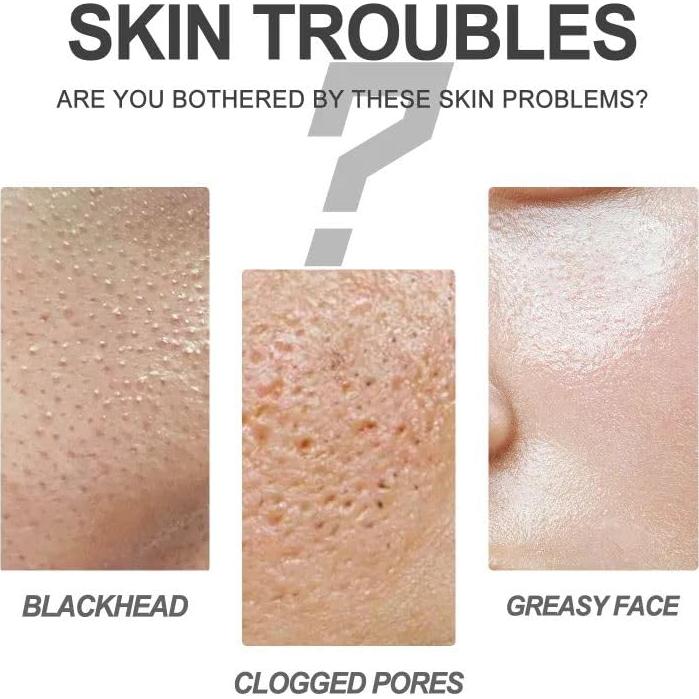 Crema Limpiadora Facial eelhoe para Puntos Negros 70g