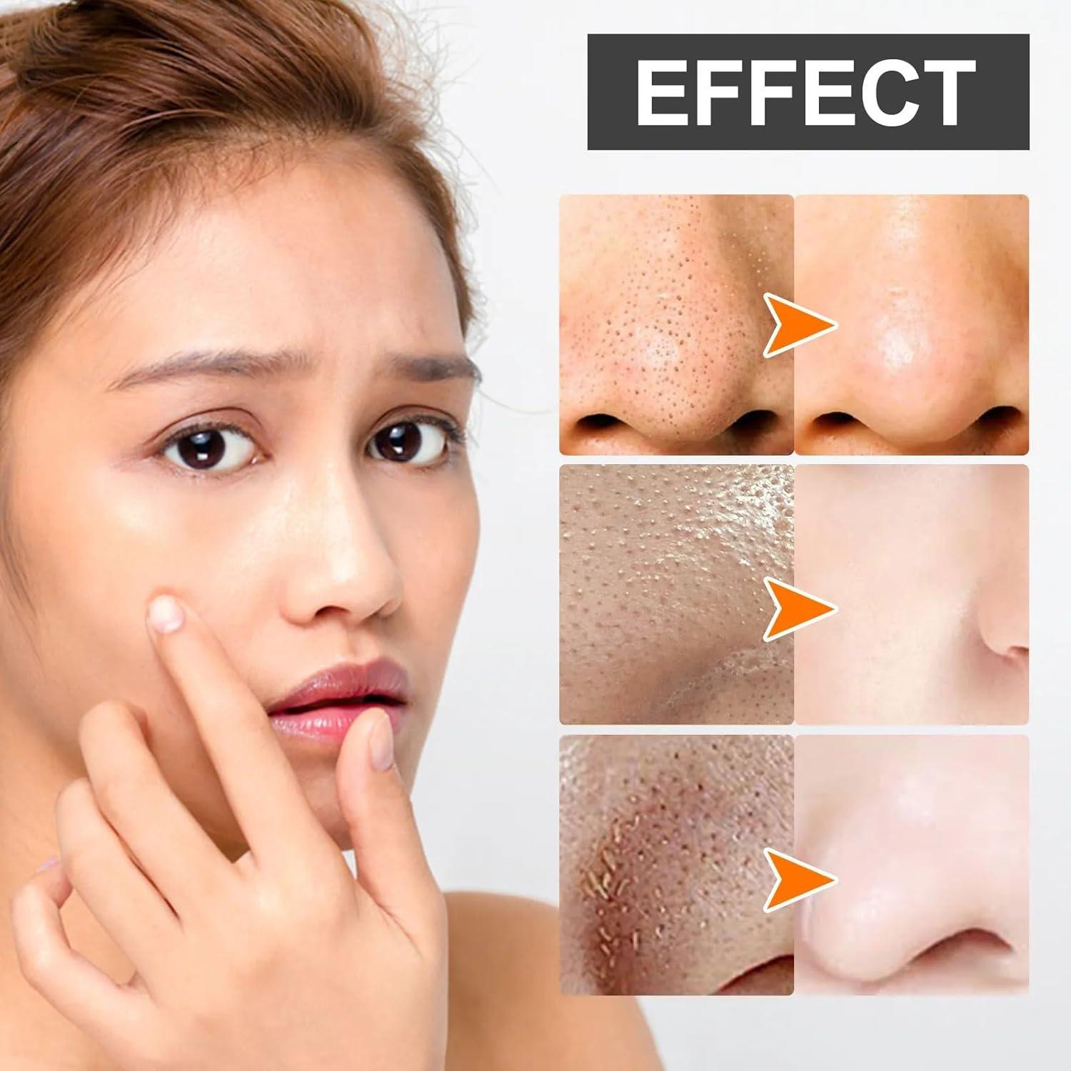 Crema Limpiadora Facial eelhoe para Puntos Negros 70g