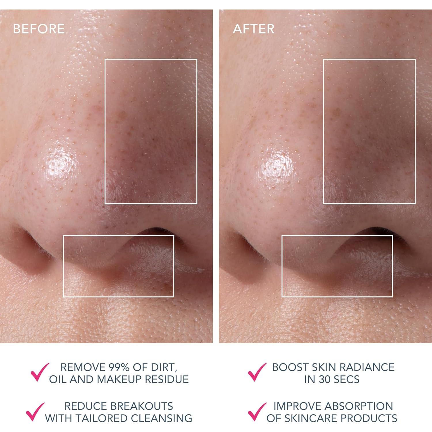 Cepillo Facial FOREO LUNA mini 3 - Limpieza Suave y Efectiva