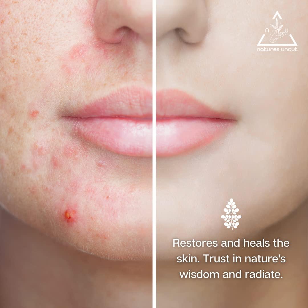 Aceite de Moringa Orgánico Nature 30ml - Hidratante Facial y Capilar