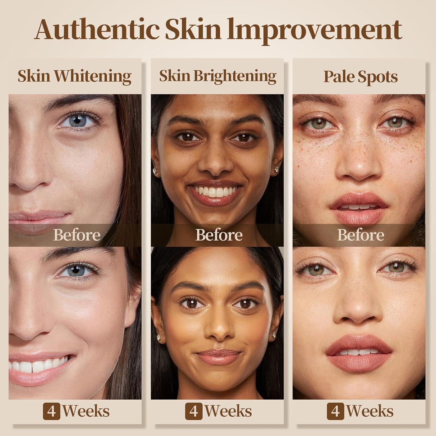 Jabón Orgánico Klyssa 100g con Ácido Kójico y Cúrcuma