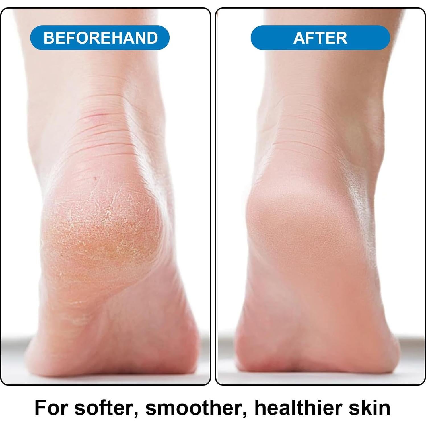 Piedra Pómez para Pies Lenpestia - Paquete de 4 Exfoliantes