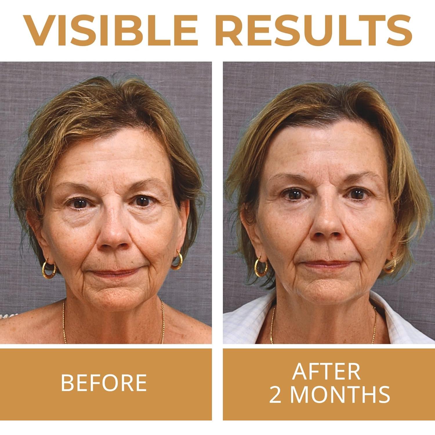 Crema para los Ojos ABERA 14.79 ml - Reduce Ojeras y Arrugas