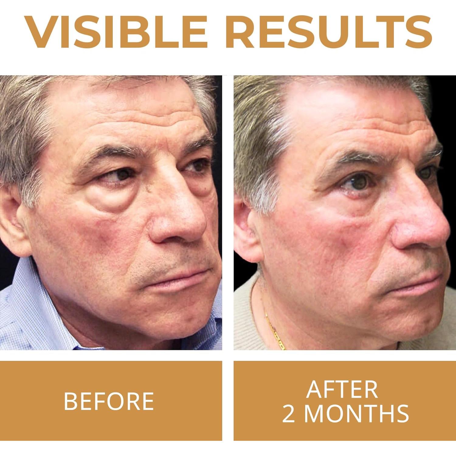 Crema para los Ojos ABERA 14.79 ml - Reduce Ojeras y Arrugas