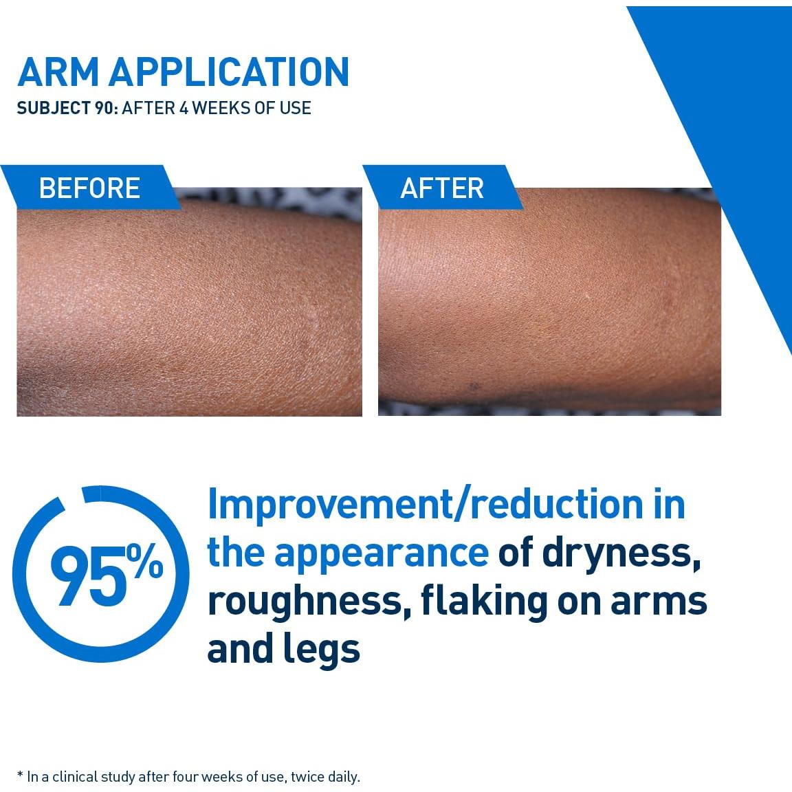 CeraVe Loción Hidratante Intensiva 236.6ml Hidro-Urea Manteca Karité