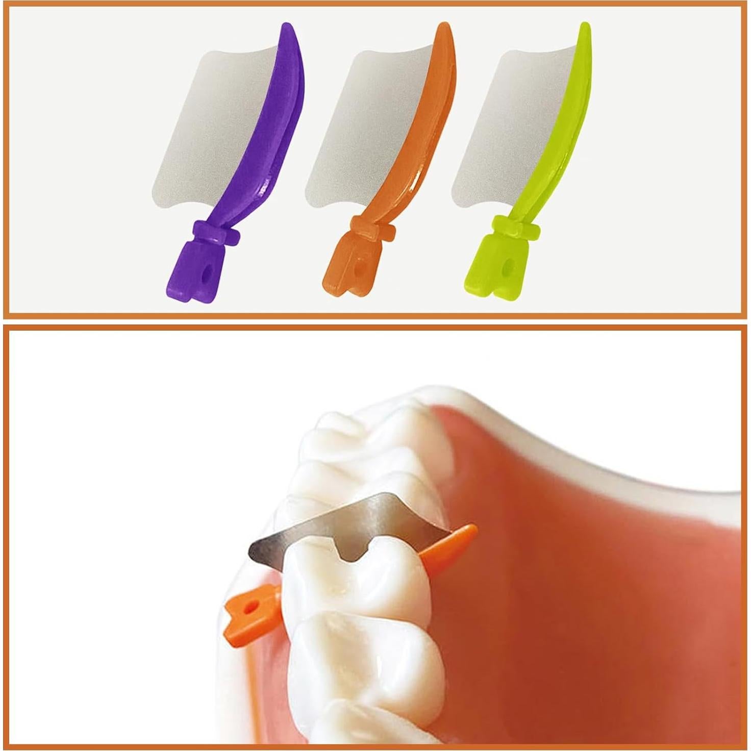 Cuchillo Dental de Cuña Windplusya Pequeño Verde 24 Pcs