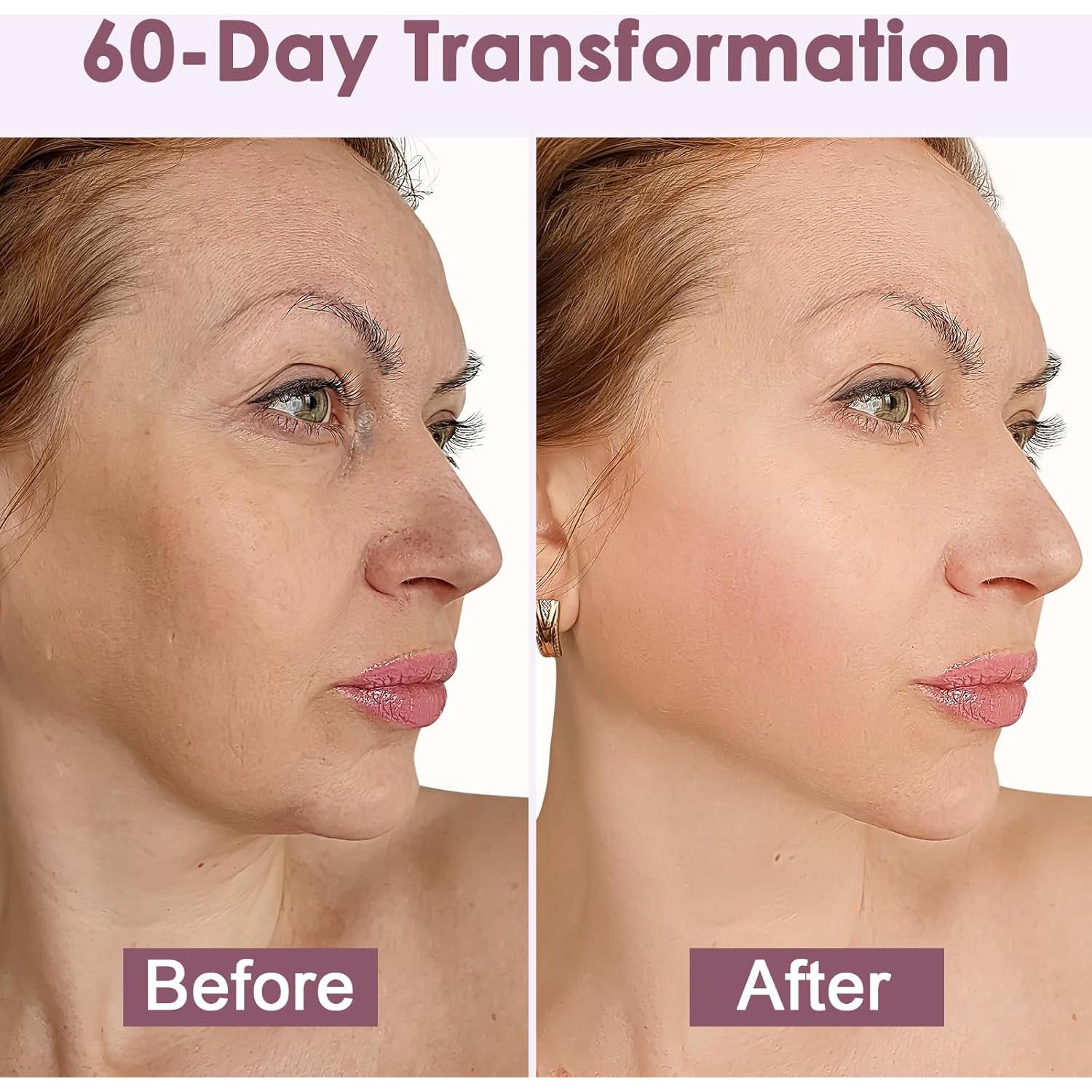 Dispositivo Facial de Microcorriente Vcycal Negro 5x14cm