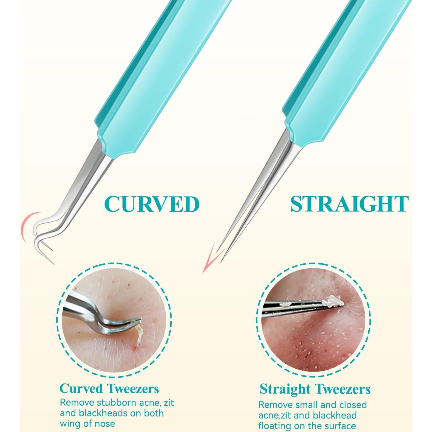 Kit de Herramientas MORGLES para Puntos Negros y Espinillas, 10 Piezas