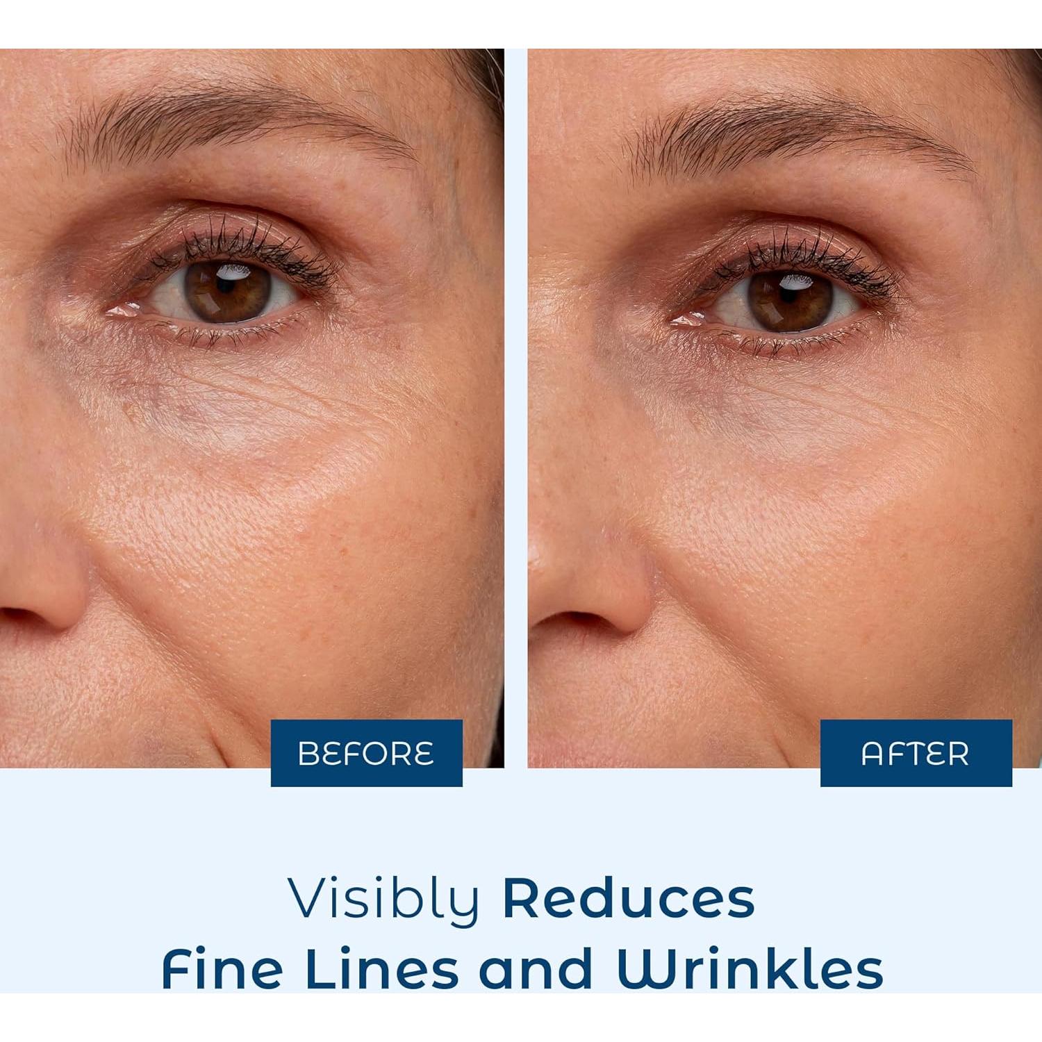 Suero de Ácido Hialurónico Cosmedica Skincare 30 ml