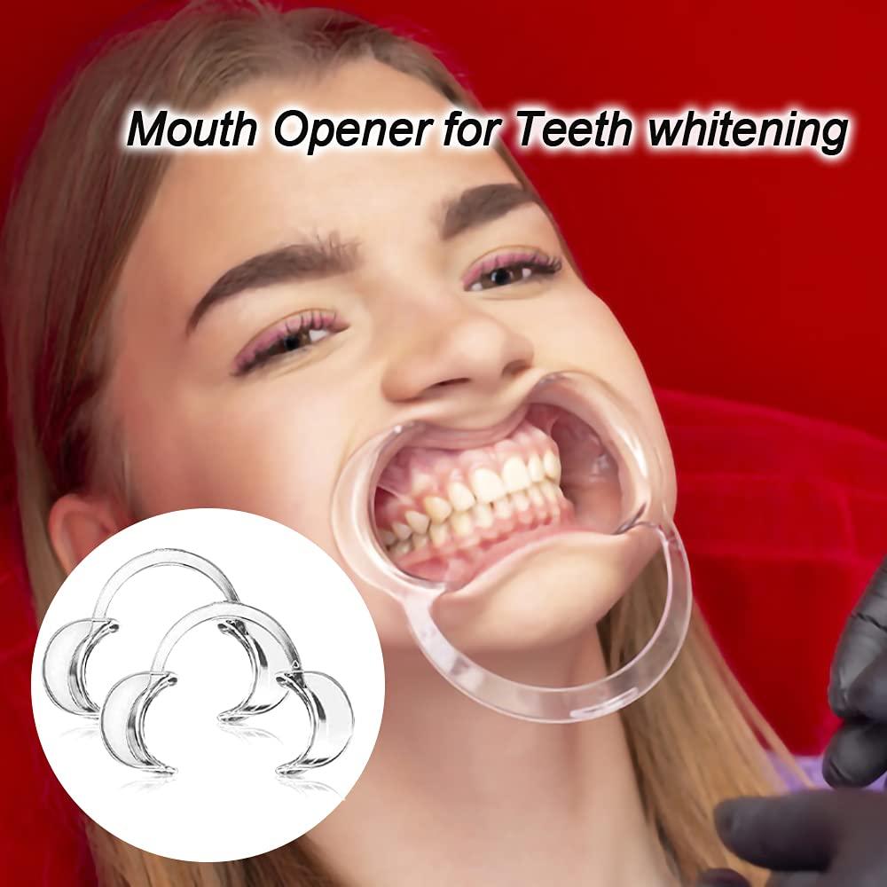 Paquete de 30 Retractores de Mejillas Dentales THINKPRICE - Autoclavables, 100% BPA Libre, Tamaño M, Transparente