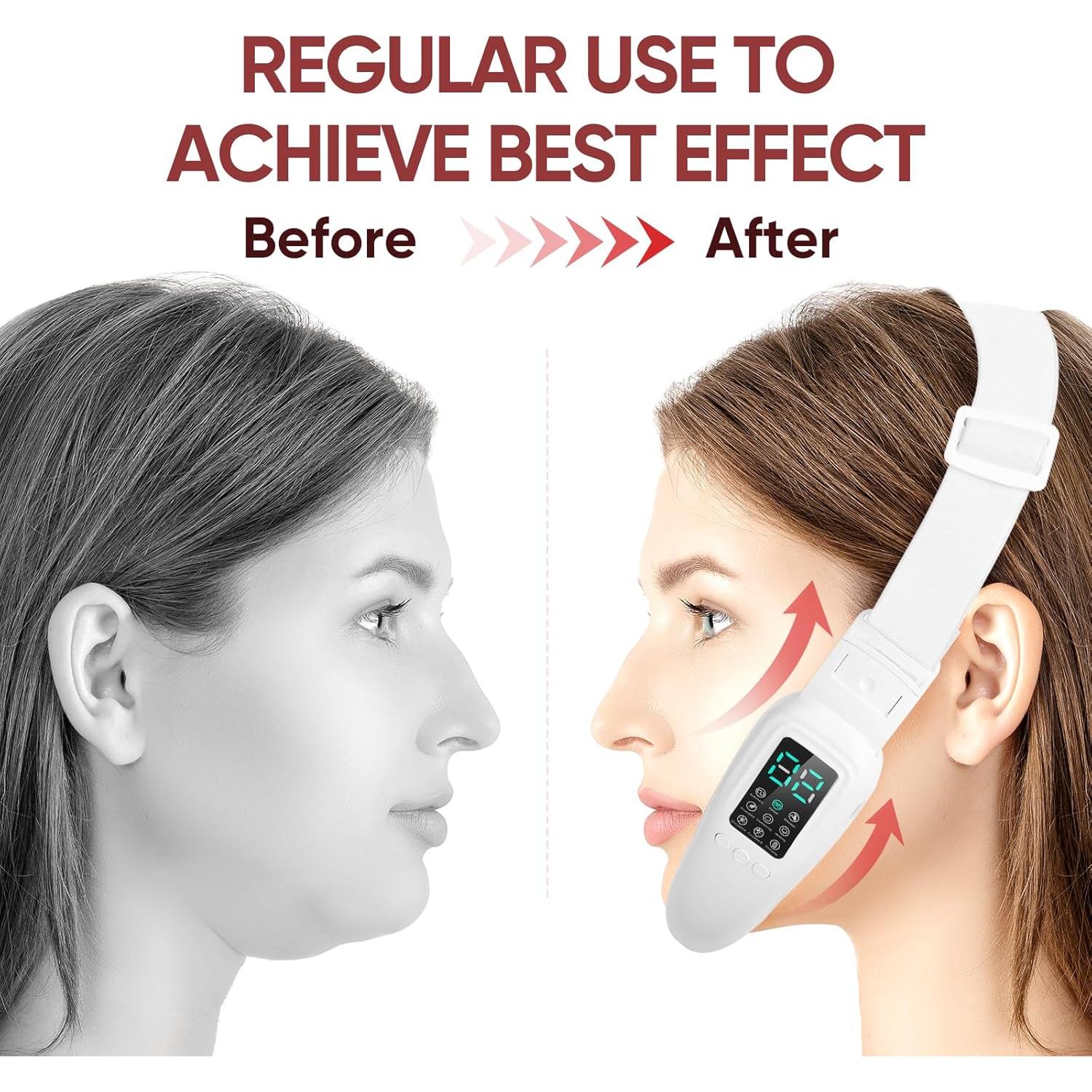 Máquina Eléctrica V-Face Ceymodir para Doble Papada 8 Modos