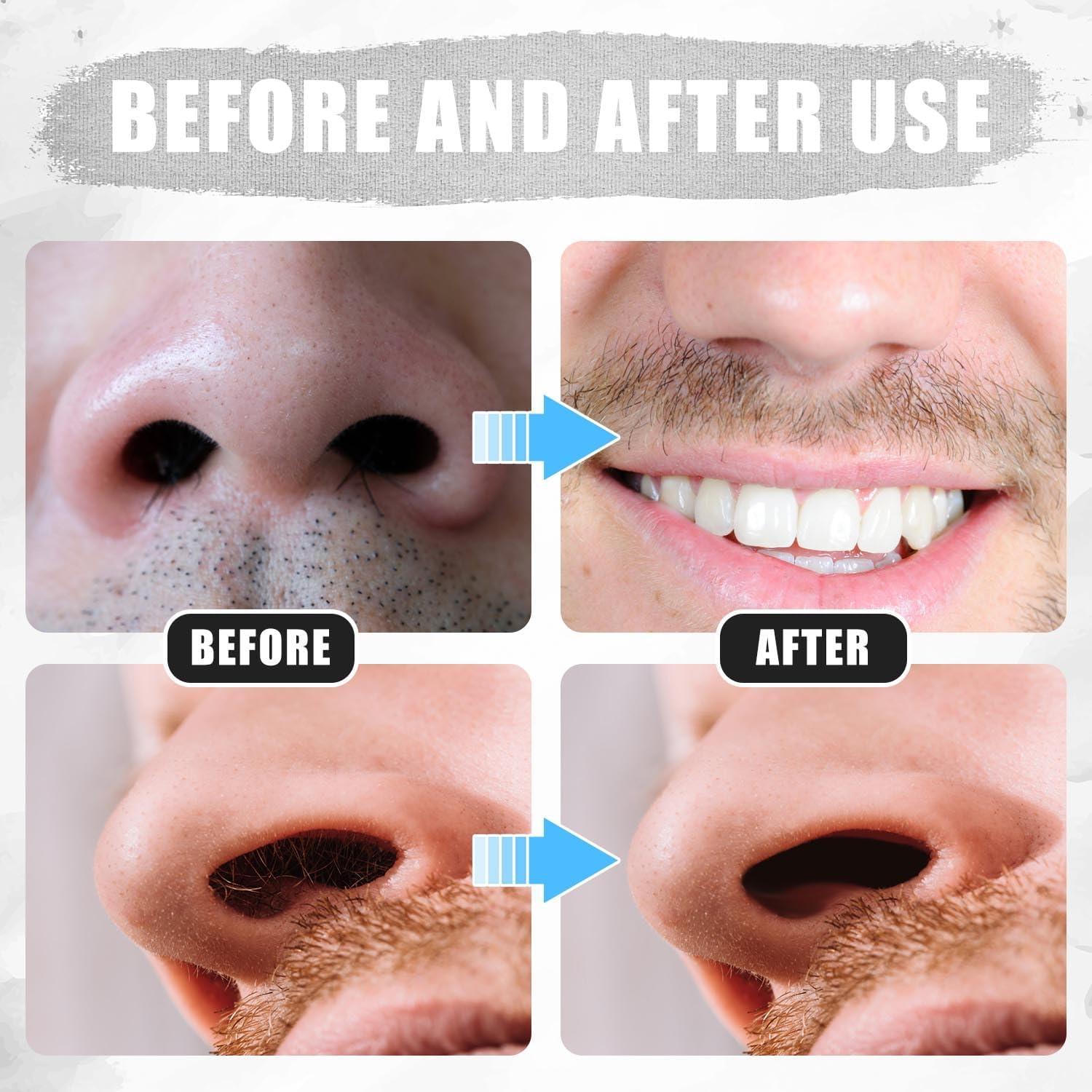 12 Cortadores de Vello Nasal 2 en 1 PEUTIER Negro