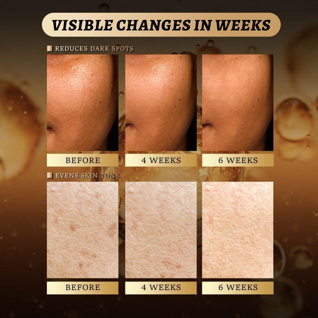 Discos Limpiadores Kóji y Cúrcuma QOOQ - 20 Piezas Exfoliantes