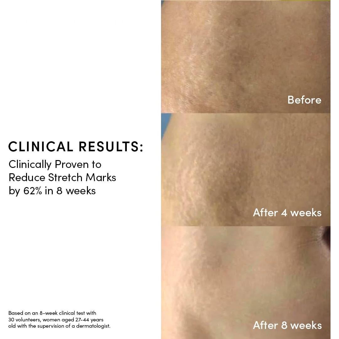 Suero Dorado Evereden 50 ml | Aceite Vegano para Estrías