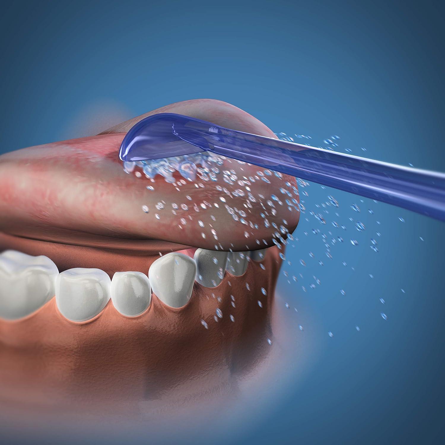 Puntas Limpiadoras de Lengua Waterpik TC-100E, 2 Unidades