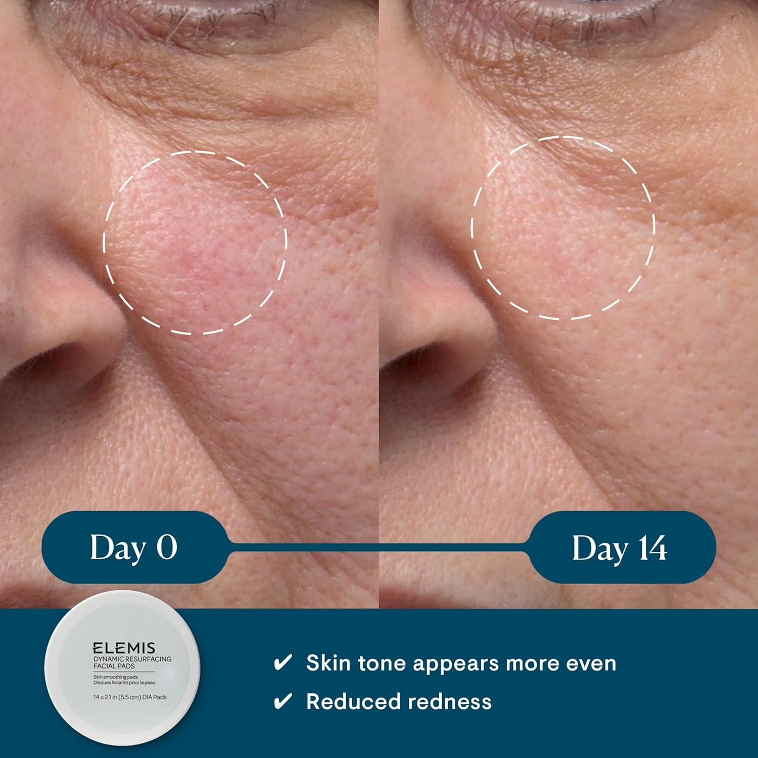 ELEMIS Almohadillas Faciales Exfoliantes Tri-Enzyme 14 Unidades