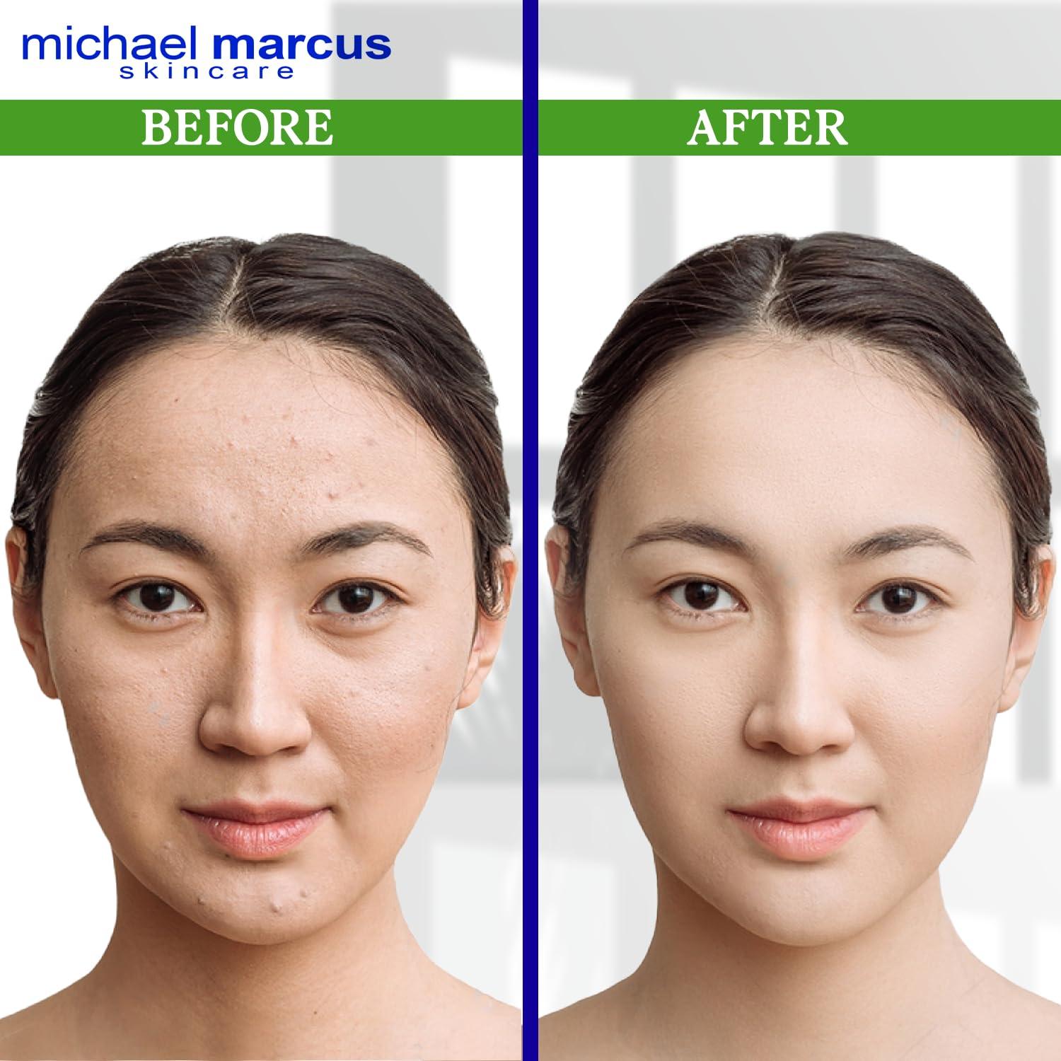 Limpiador Facial Espumoso Michael Marcus Aloe 118 ml - Hidratante