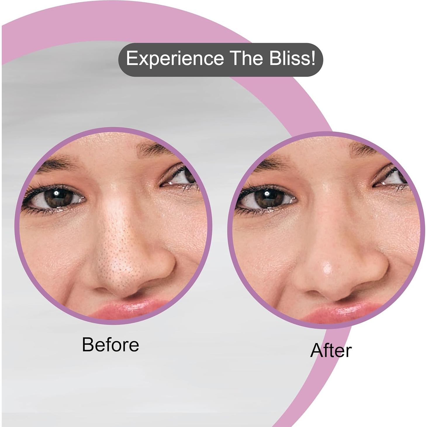 Tiras de Pore de Carbón DR.Rashel para Nariz - 20 PCS