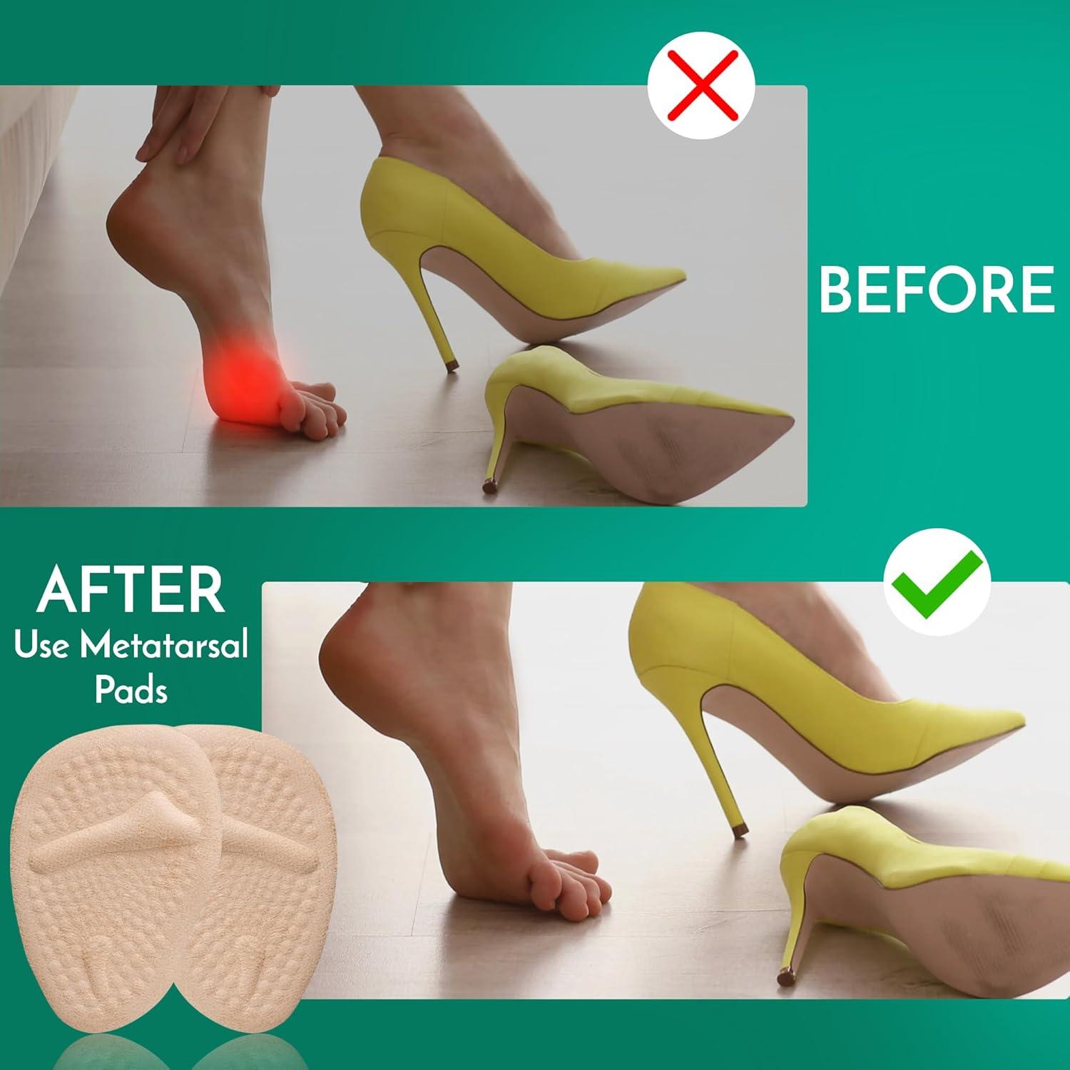 Almohadillas Metatarsales Comfwalk 3 Pares Beige - Alivio Dolor Tacones