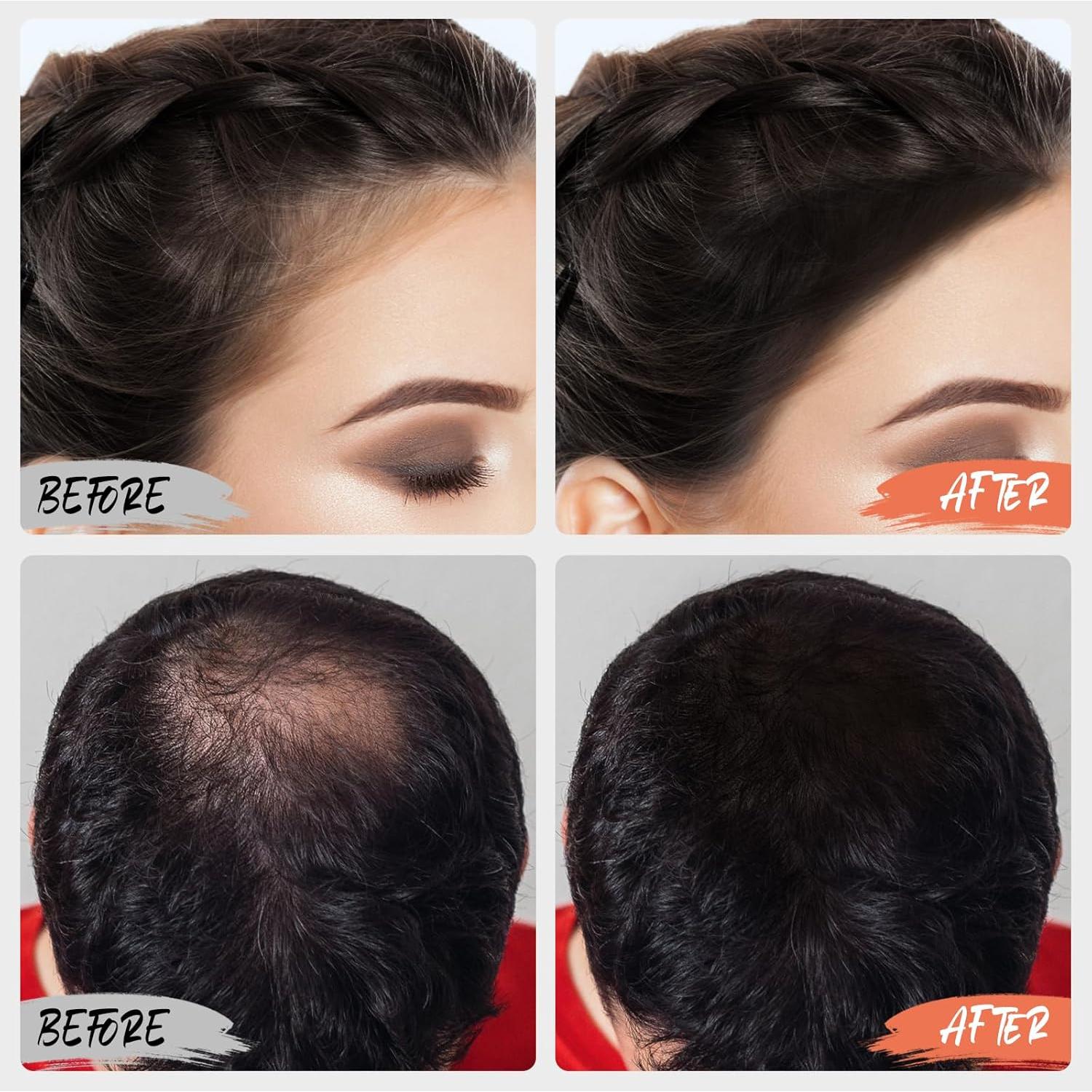 Boobeen Root Touch up Hair Powder,Root Cover up Hairline Powder,Temporary Hair Color for Gray Hair Coverage Touch up Hair Shadow Powder for Thinning Hair for Men and Women