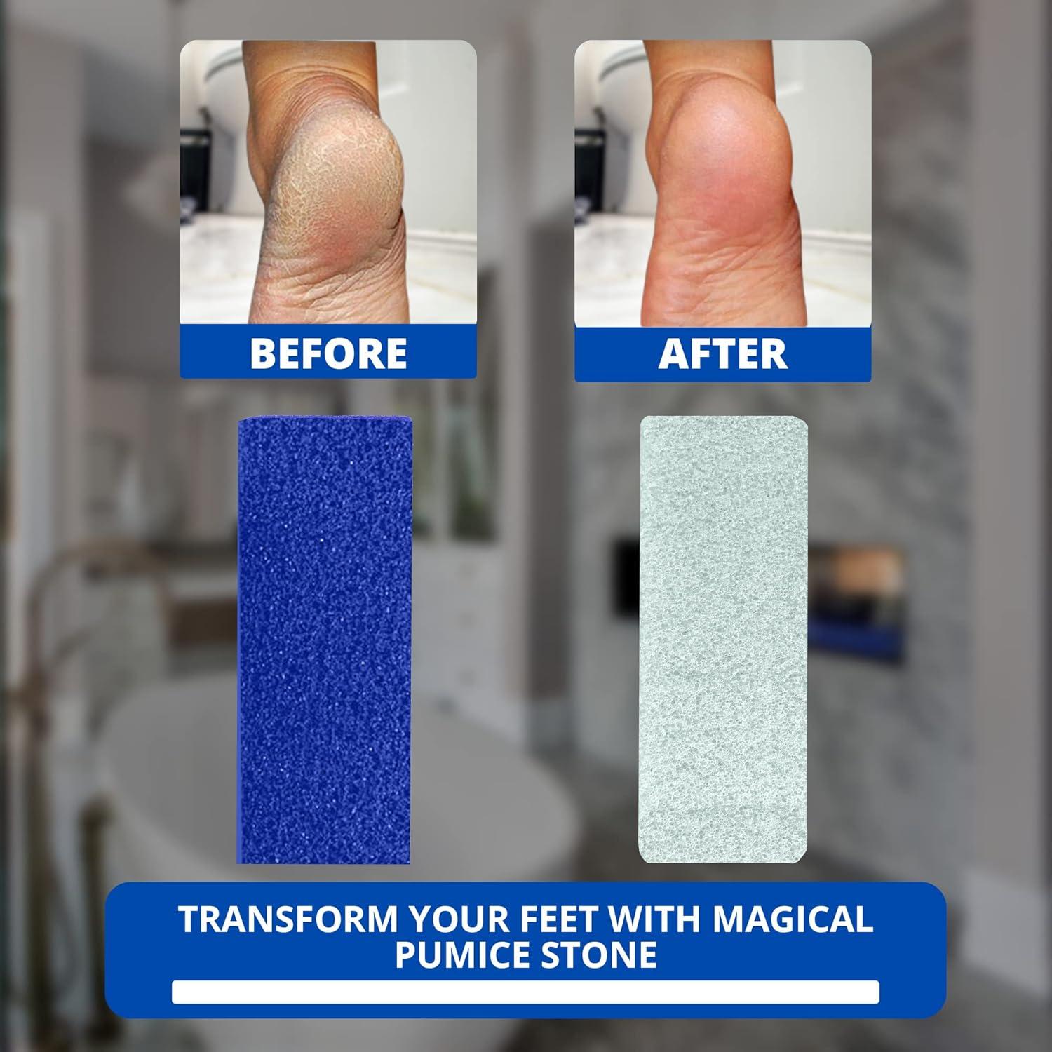 Piedra Pómez Exfoliante LOVE PUMICE para Pies y Manos Azul