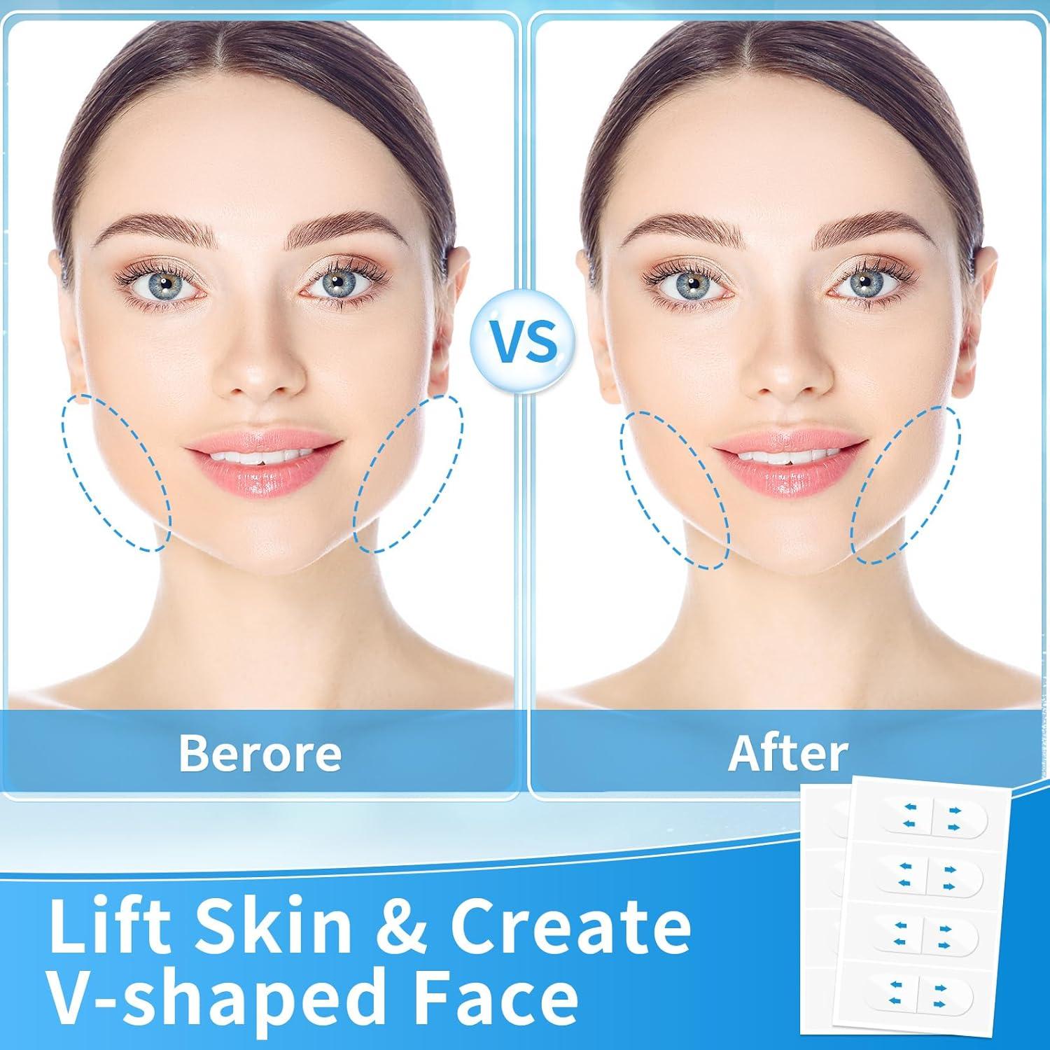 Cinta de Lifting Facial Invisible Netlkjonk 156PCS Antienvejecimiento