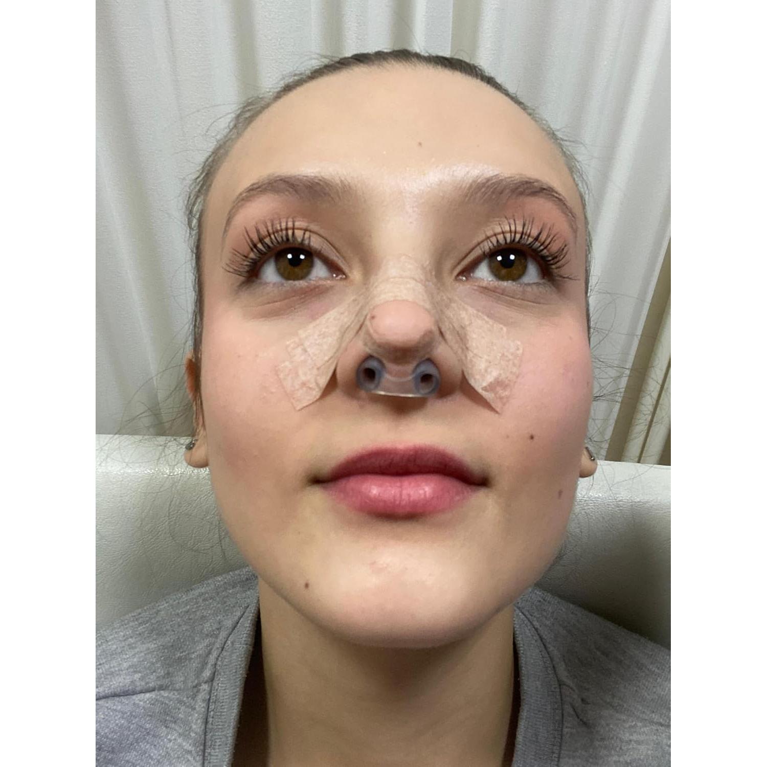 Retenedor de Nostril Nanovita + Cinta Quirúrgica Micropore