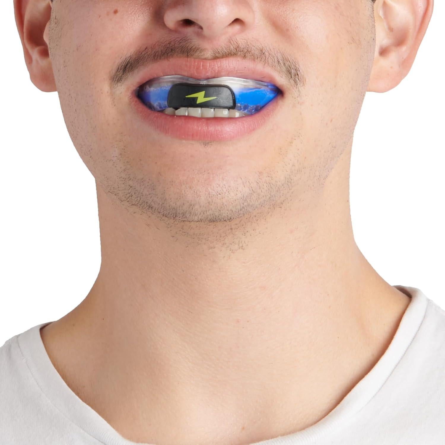 Kit Protector Bucal Zone - Ajuste Personalizado Sin Dolor Azul