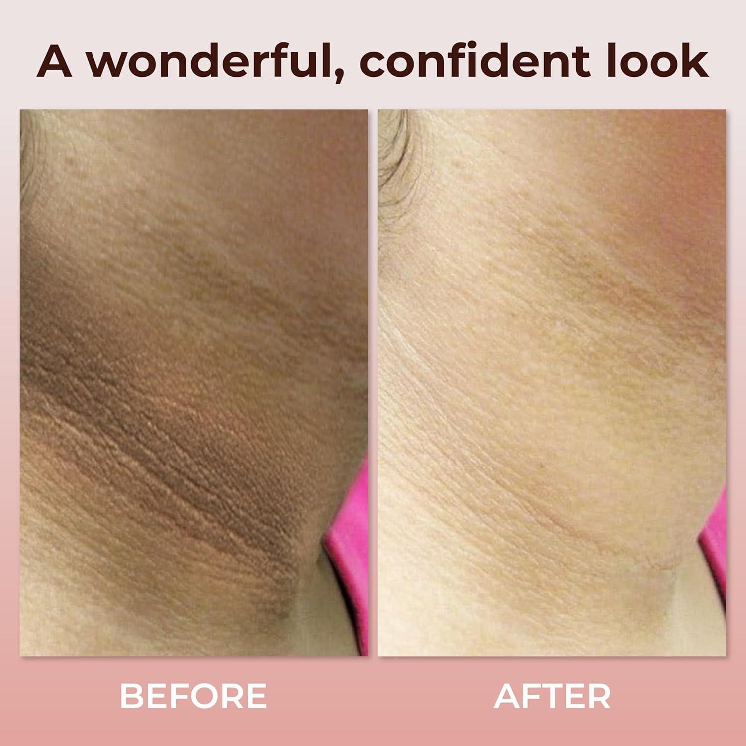 Crema de Cuello Abera con Colágeno y Niacinamida 52.7 ml