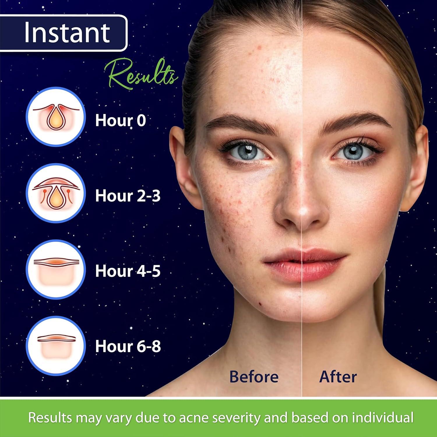 Parche para Granos Estrella NC Natural Cures - 40 Unidades