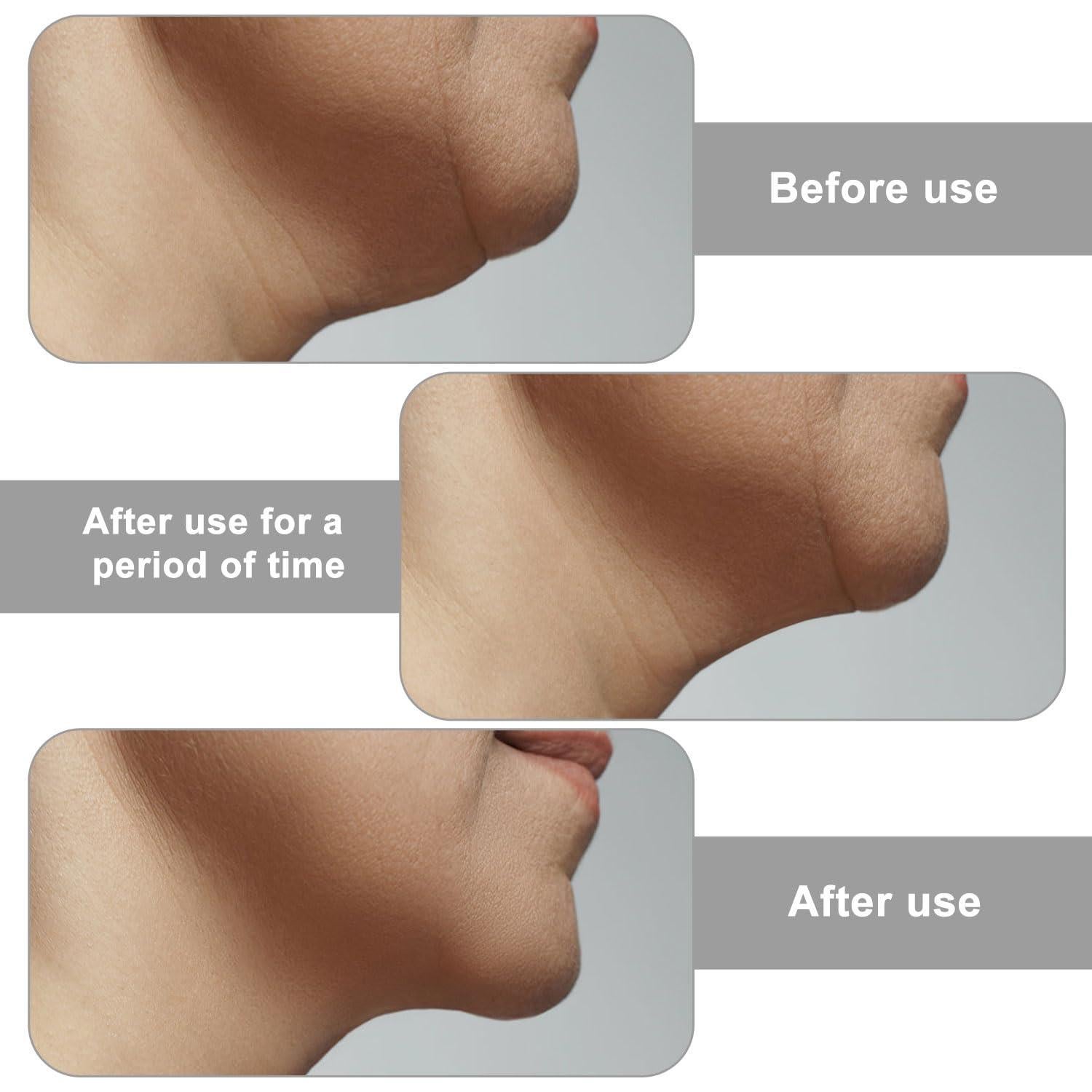 Correa de Nylon V-Line Lifting para Papada BOXOB - Ajustable