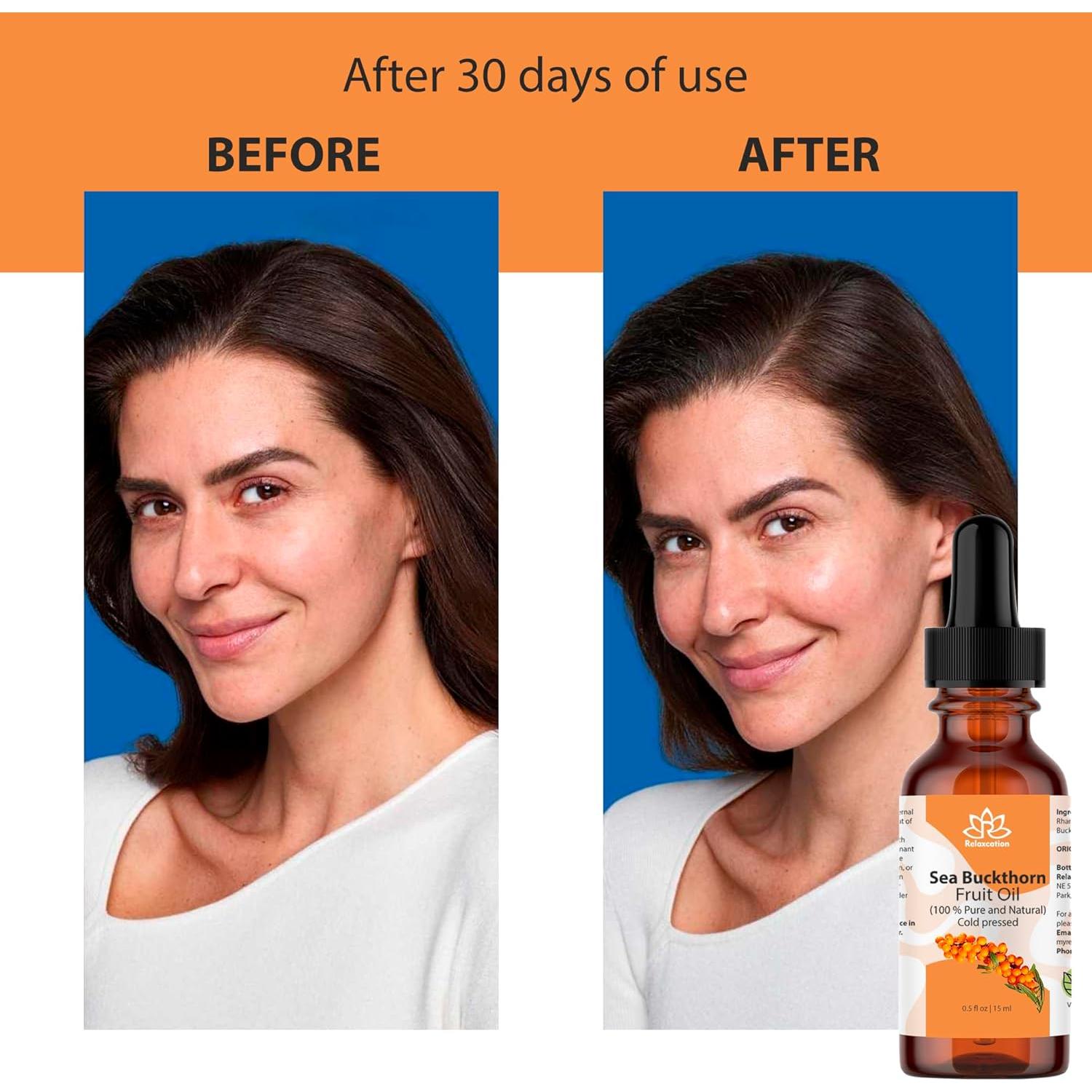 Aceite de Fruta de Espino Marino Relaxcation 14.79 ml - Hidratante Natural