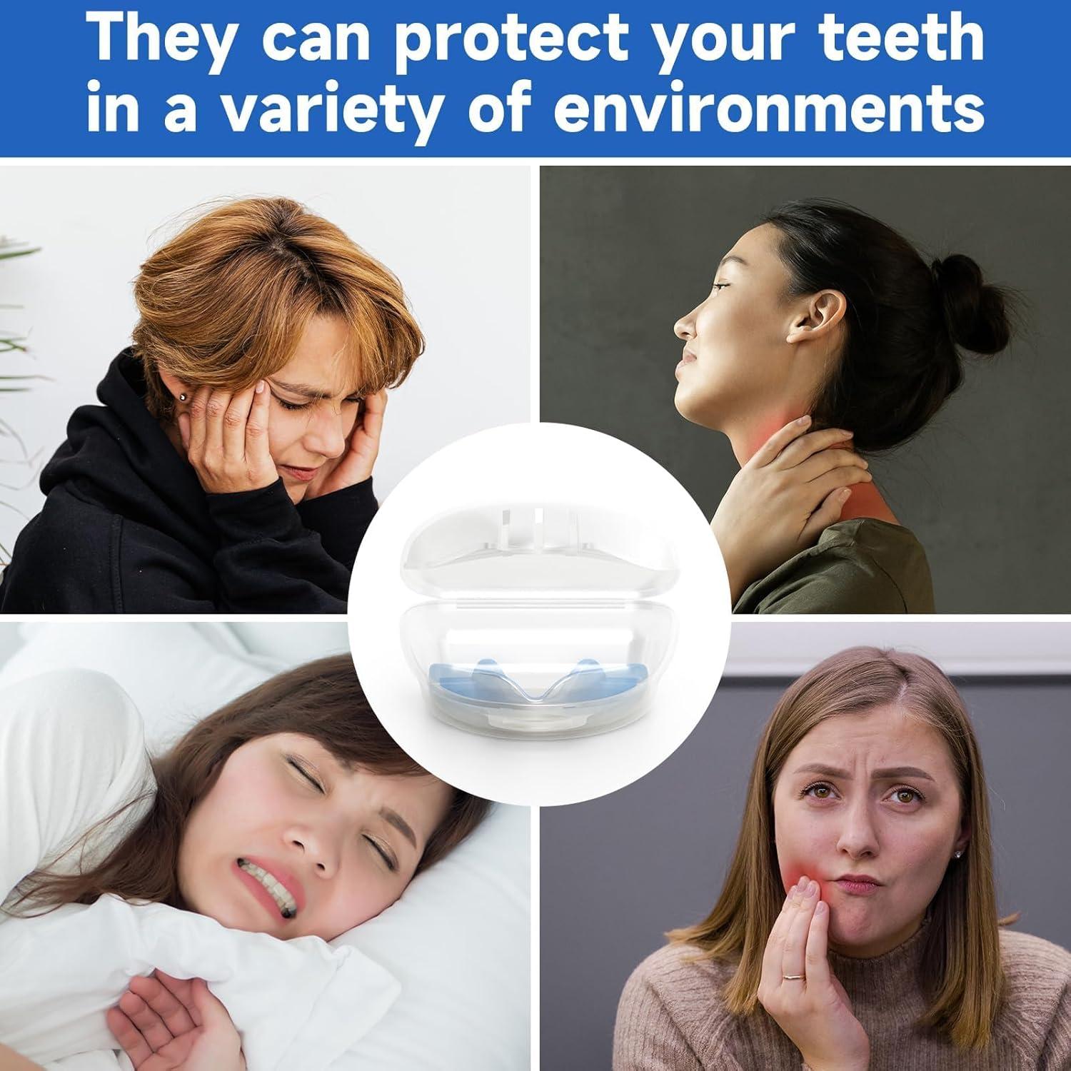 Paquete de 4 Protectores Bucales Azules BOKZEN para Niños
