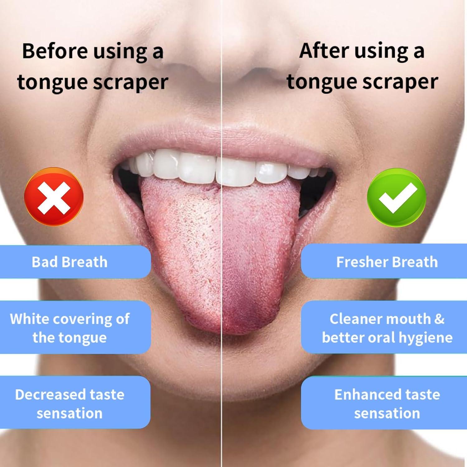 Cepillo de Dientes Eléctrico JTF Negro con 6 Cabezas y 5 Modos