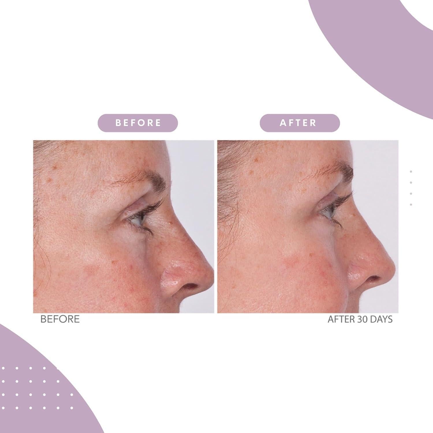 Crema para los Ojos Reafirmante Serious Skincare 1 Onza