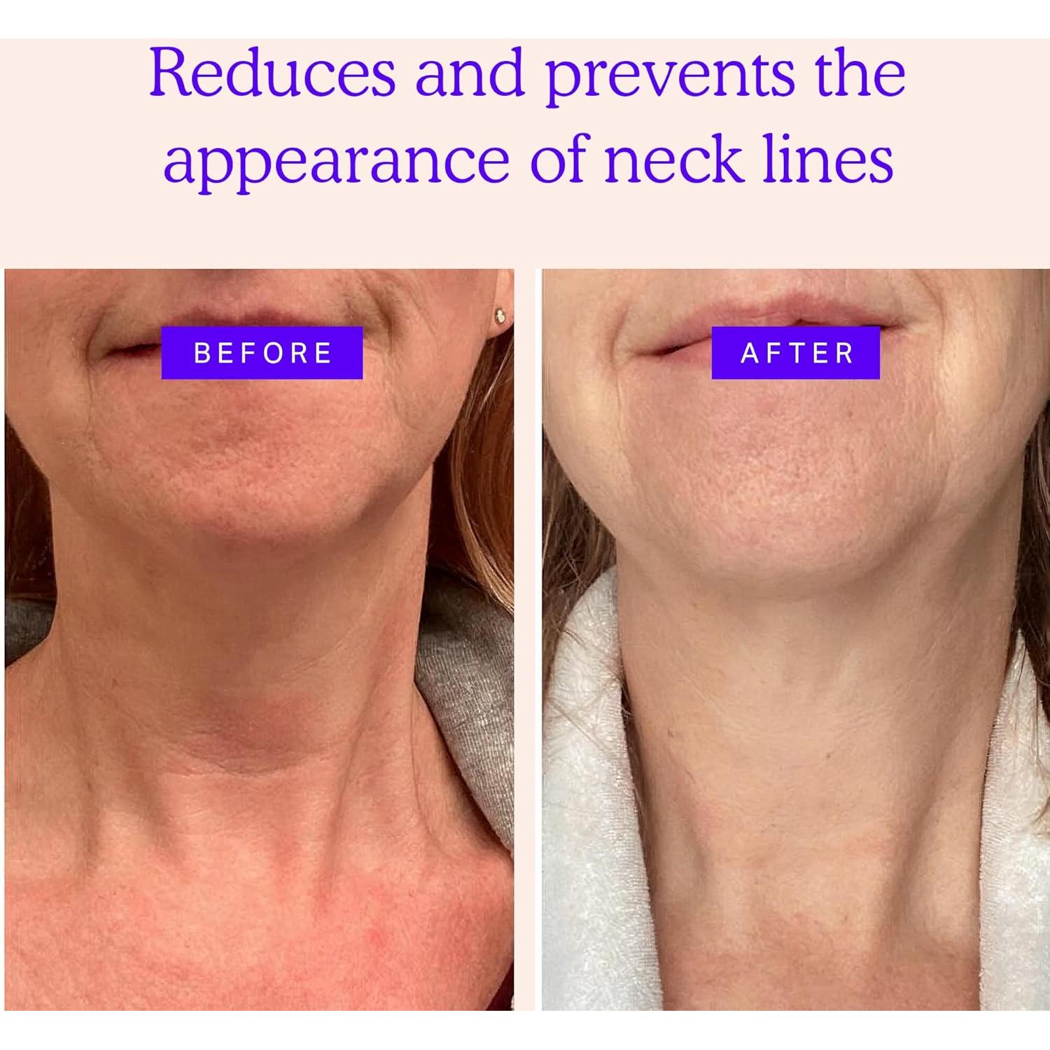 Parches Antienvejecimiento Blumbody para Cuello - Silicona Reutilizable