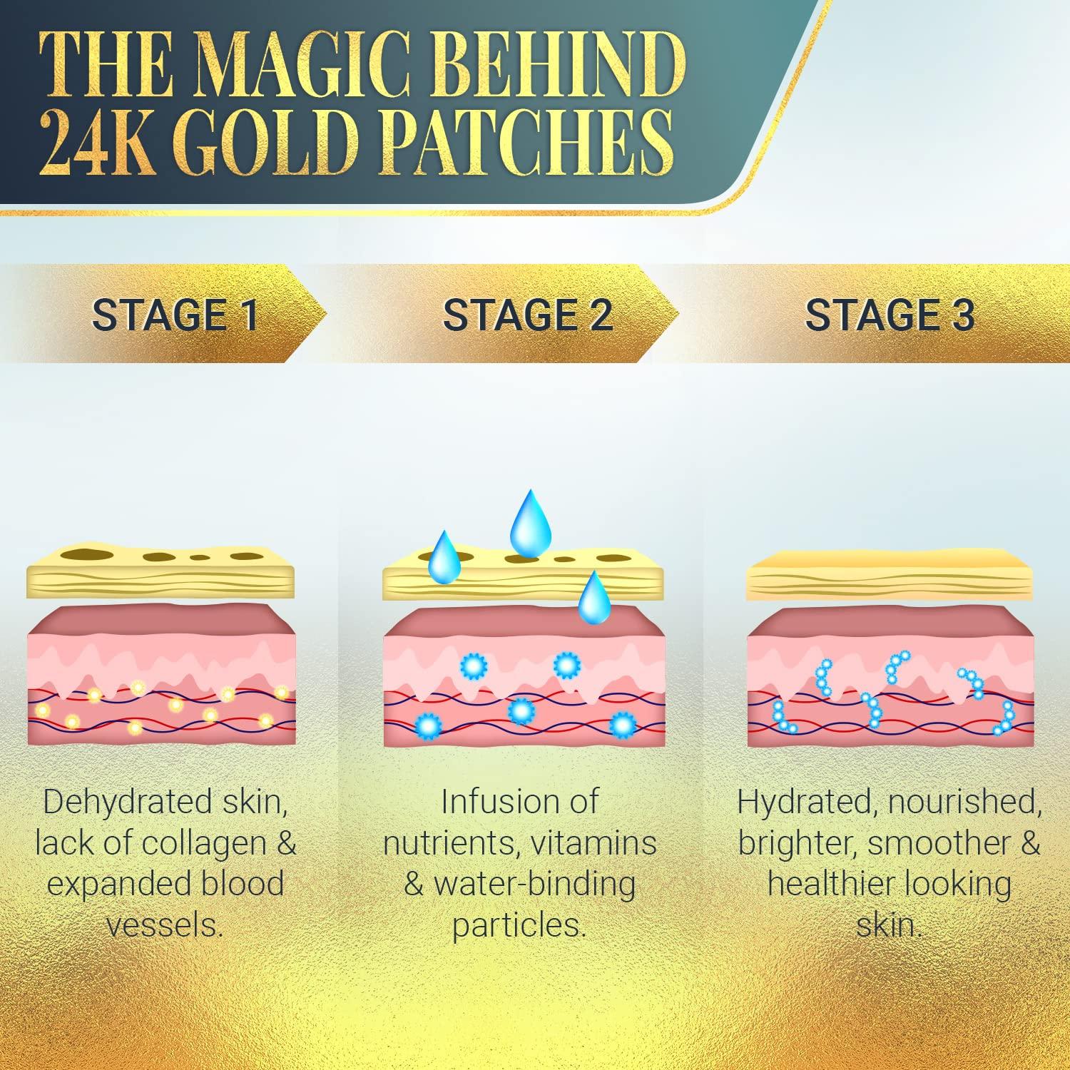 Parches Antiarrugas Matykos - Colágeno y Ácido Hialurónico - 20 Sachets