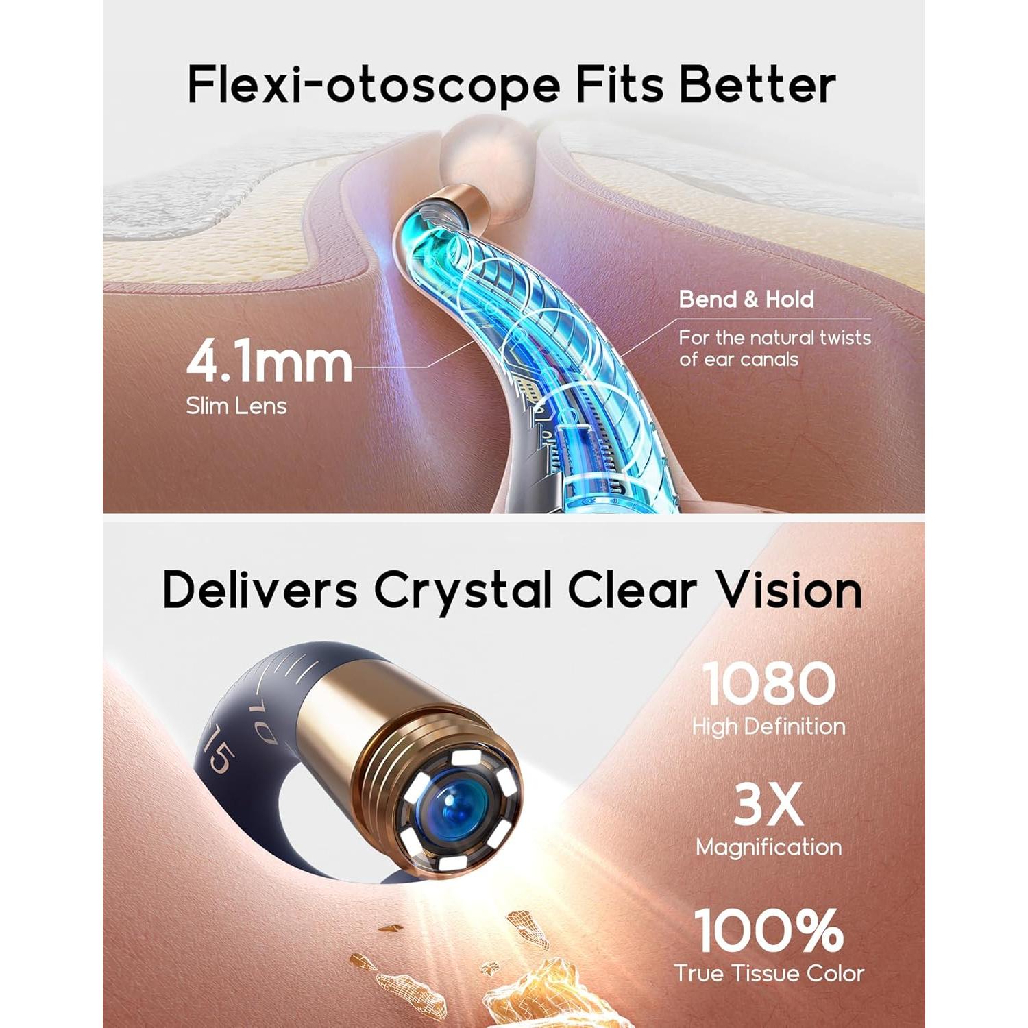 Limpiador de Oídos Earsight Plus I35R con Cámara HD y 12 Puntas