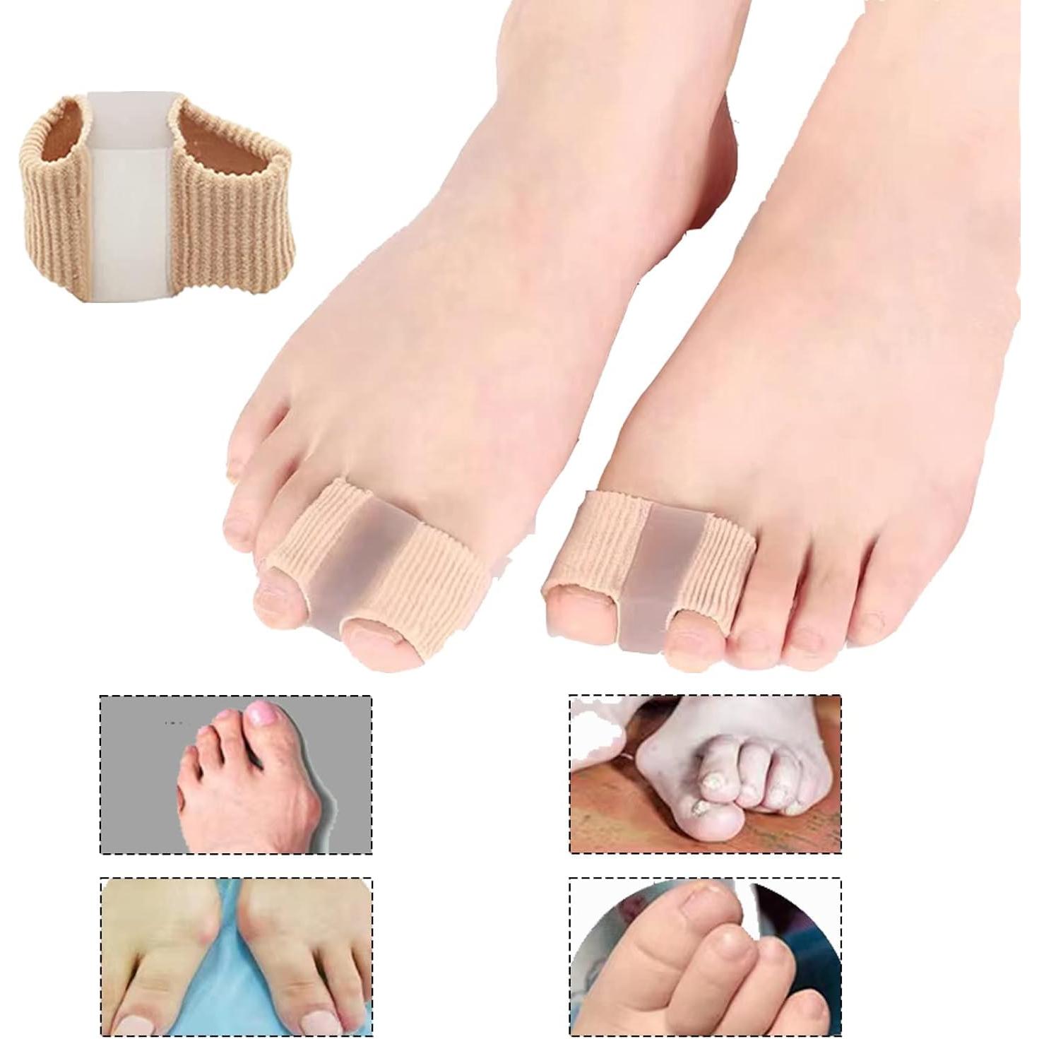 Separadores de Dedos de Gel Whycalon 2PCS para Juanetes