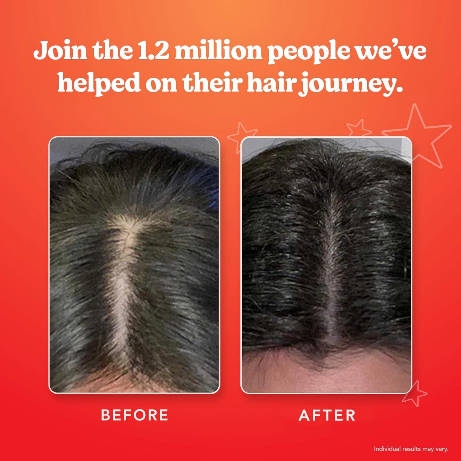 Suero Capilar HAIRtamin 59 ml - Crecimiento y Grosor del Cabello