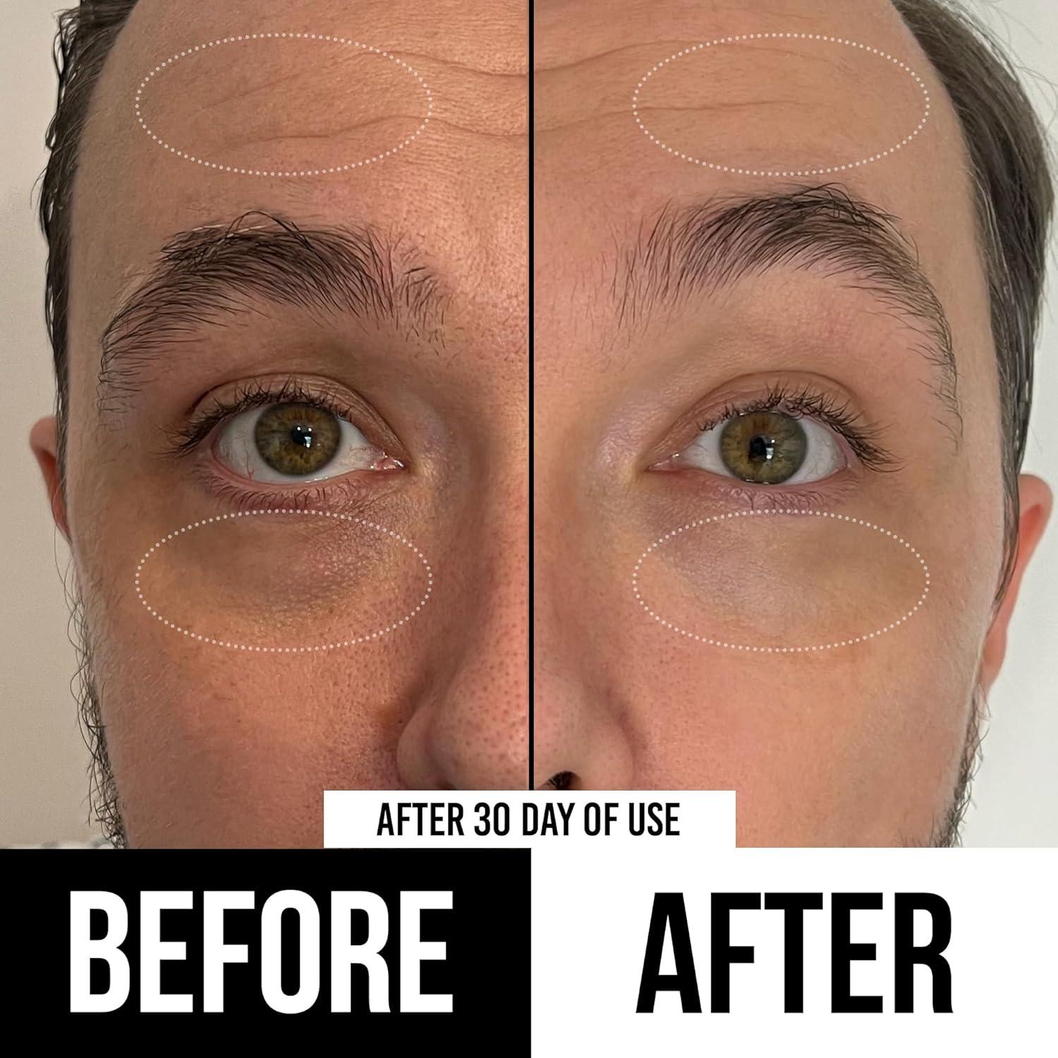 RUGGED & DAPPER Premium Men's Eye Cream | Age Defense for Dark Circles, Wrinkles & Puffy Eyes | Unscented | Hyaluronic Acid, Aloe + Argan Oil