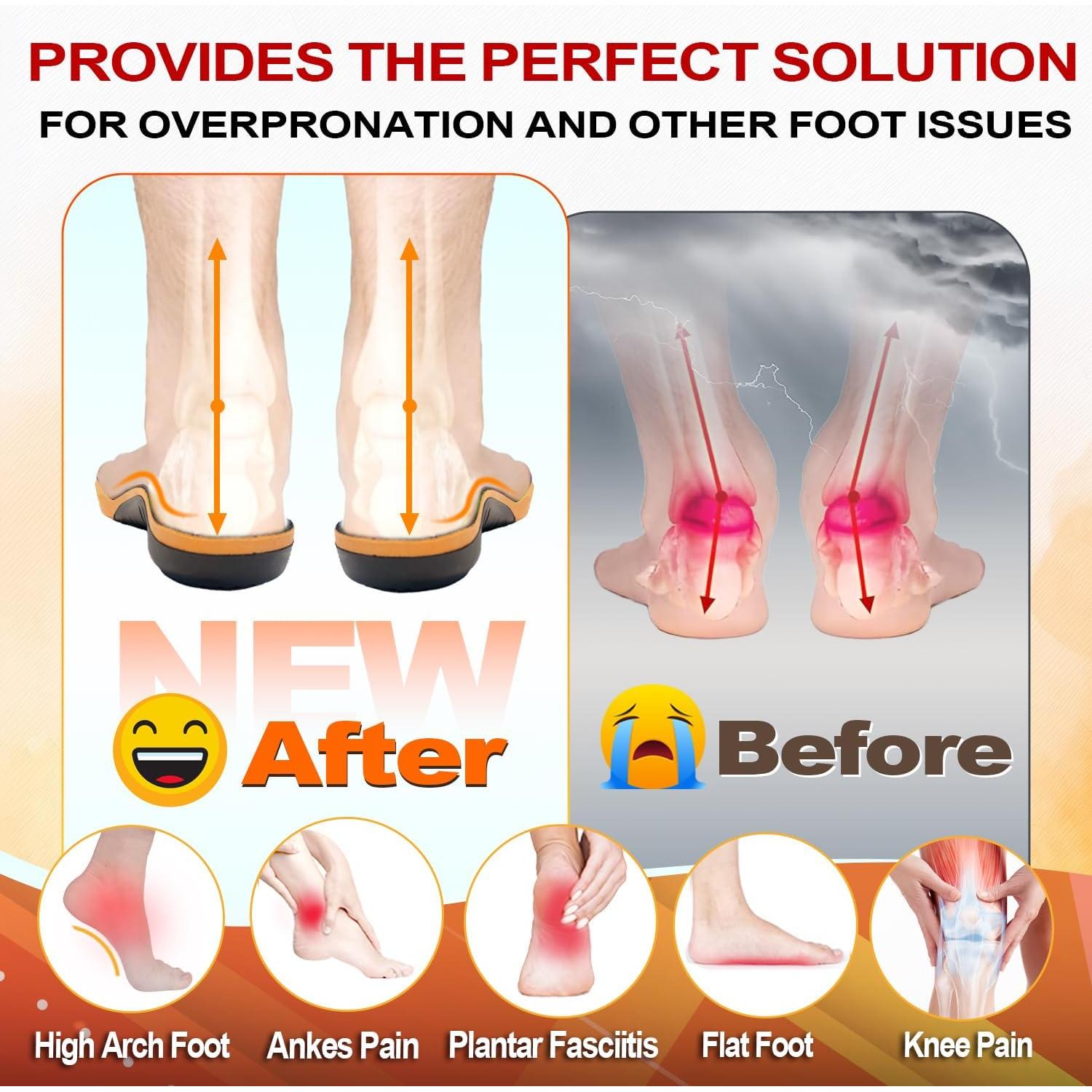 Plantillas Ortopédicas XPACS para Fasciitis Plantar - Soporte Alto