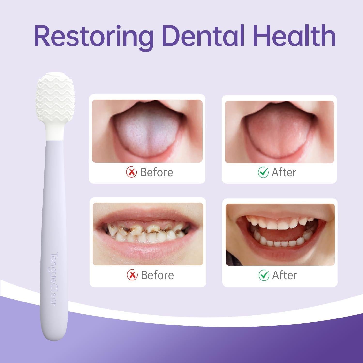 Raspador de Lengua para Bebés Tongueclear 360° - Limpiador Oral