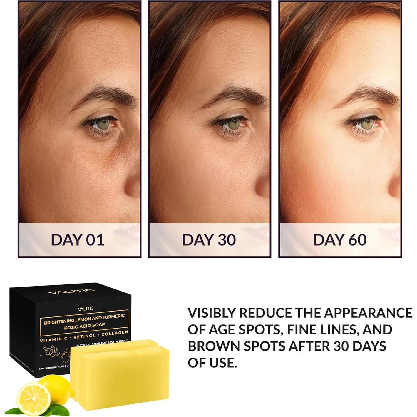 Jabón Aclarador Valitic de Limón y Cúrcuma 2 Paquete