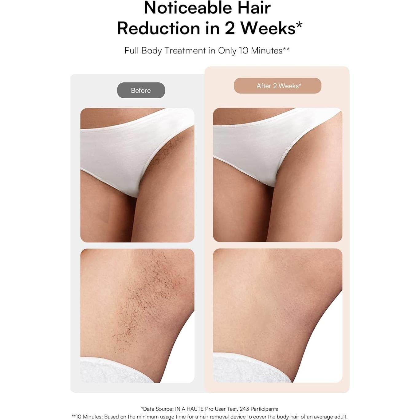 Eliminador de Vello Láser INIA HAUTE Pro IPL Indoloro 308g