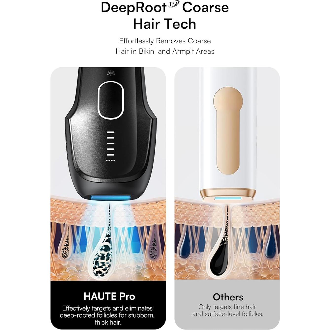 Eliminador de Vello Láser INIA HAUTE Pro IPL Indoloro 308g